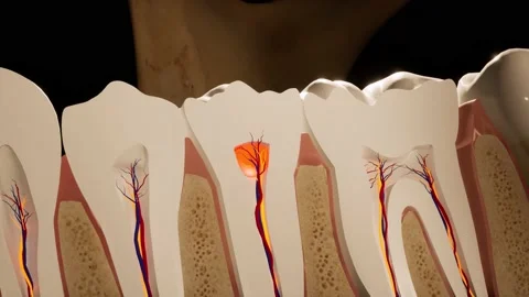 Toothache. Anatomical detailed section o... | Stock Video | Pond5
