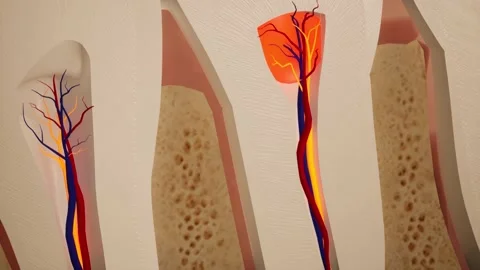 Toothache. Anatomical detailed section o... | Stock Video | Pond5