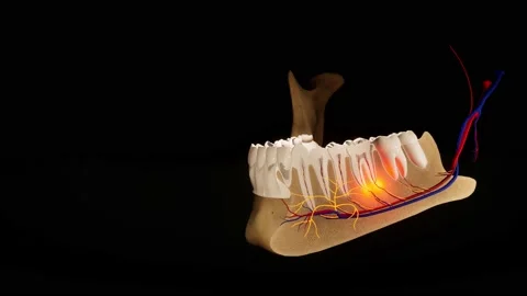 Toothache. Anatomical detailed section o... | Stock Video | Pond5