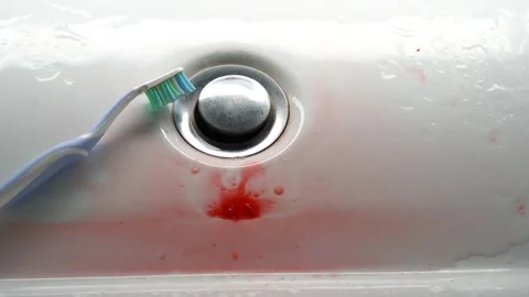 Toothbrush in a white washbasin with blood. Problem with gums. Stock Footage 244736869