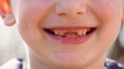 Toothless smile of a child Stock Footage 181982632