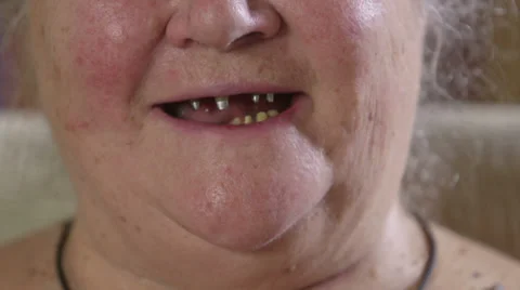 Toothless smile Stock Footage 25149524