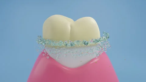 Toothpaste cleans yellow teeth, removes tartar, and whitens teeth Video stock 246614319