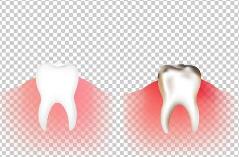 Tooths Stock Illustration