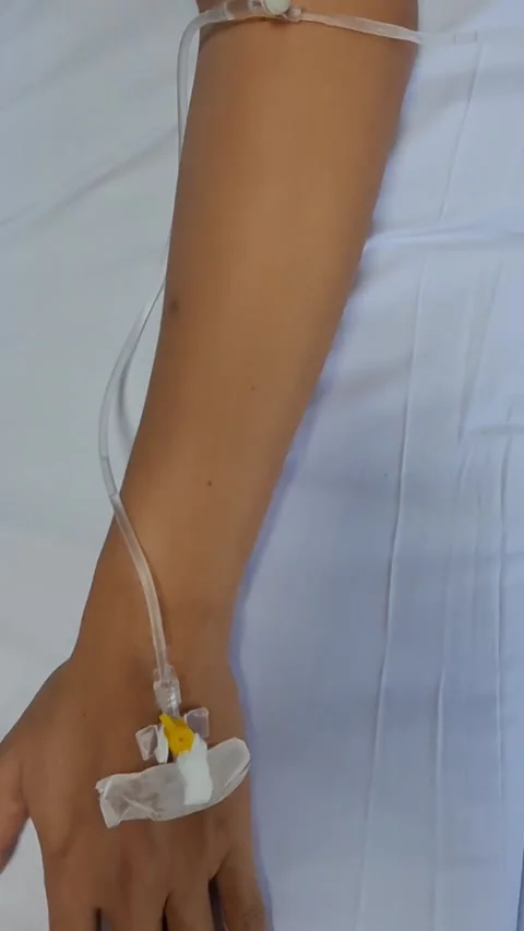 Top Angle View of Patient Hand Receiving Intravenous Fluid Video stock 341411509