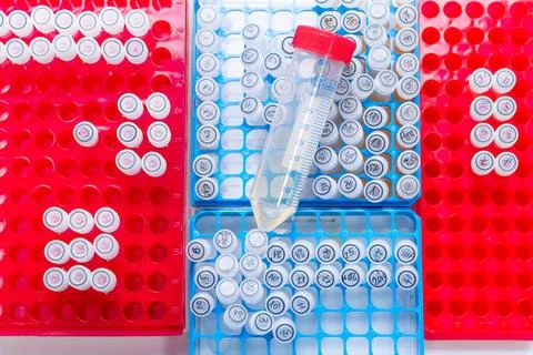 Top-down view of different trays of test tubes with big measuring vessel in Stock Photos