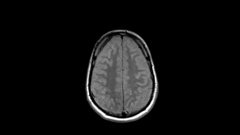 Top MRI Brain Scan Stock Footage 104435753