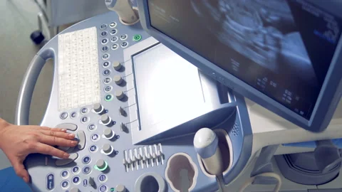 Top view of a functioning ultrasound equipment. Video stock 88205163