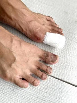 Top view of human feet with a white medical bandage Stock Photos