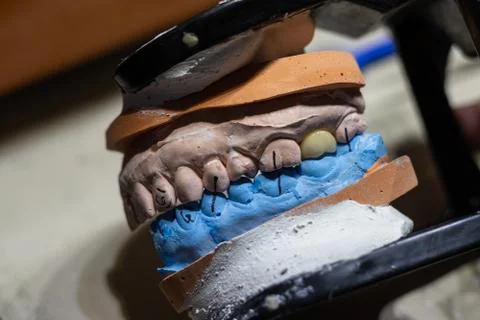 Top view of jaw mold with a almost finish prosthetic tooth Stock Photos