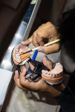 Top view man working in a tooth for a prosthetic Stock Photos