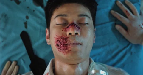 Top view of paramedics hands putting on oxygen inhalation mask on asian man face Stock Footage 139362220
