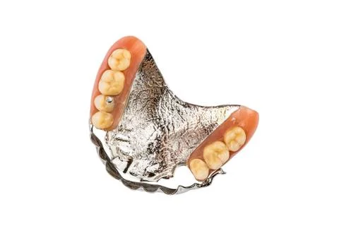 Top view of partial metal removable swinglock denture on white background. Stock Photos