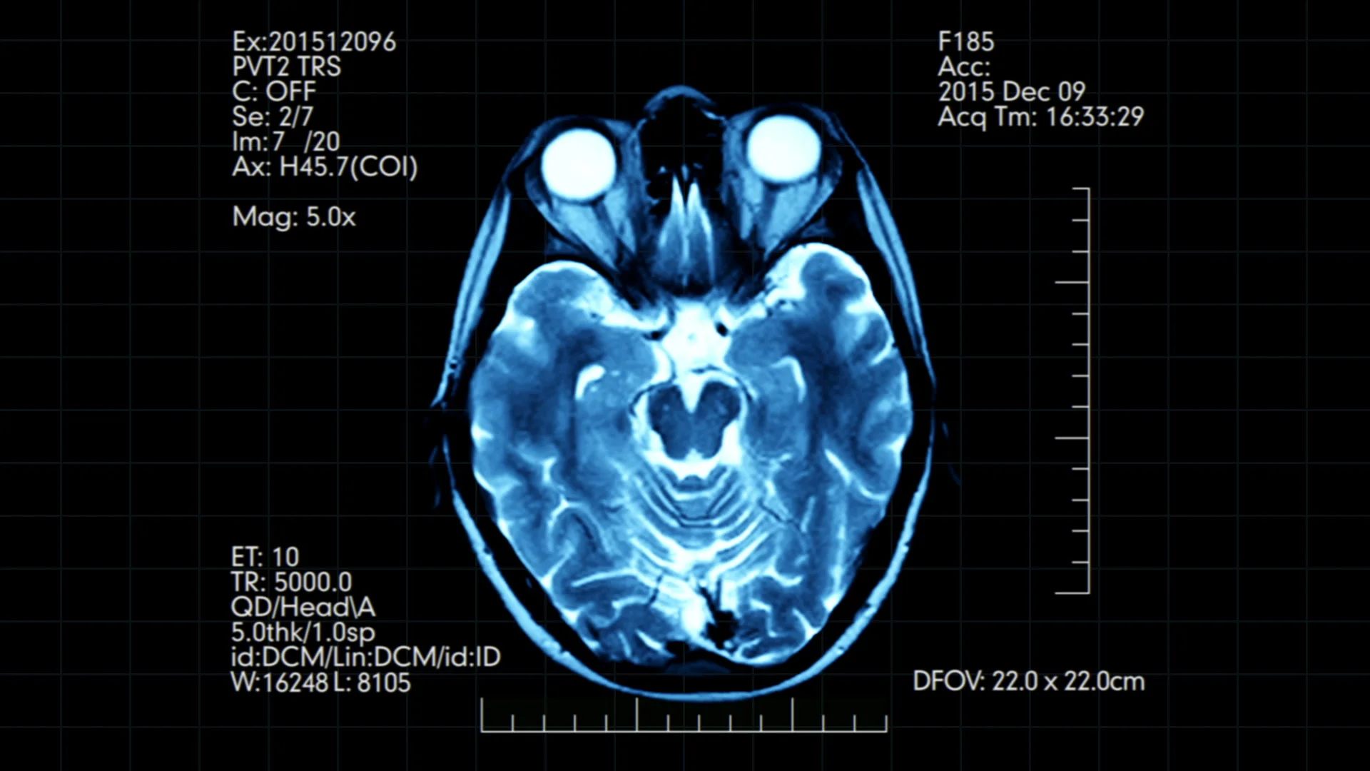 Top view teal color MRI brain scan displ... | Stock Video | Pond5
