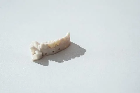 Top View Teeth Crowns, Bridge Dental Equipment Model For Tooth Restoration Stock Photos