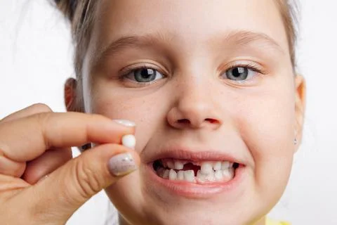 Torn out milk tooth between two fingers in front of little girl face behind with Stock Photos