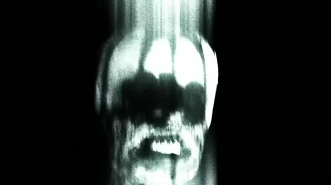 TORTURE VICTIM VIOLENT SHAKE WITH SOUND Stock Footage