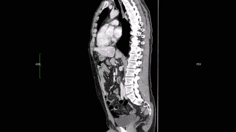 Total Body scanner 360 - 4K - ProRes Stock Footage 164237988