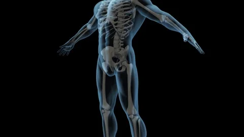 Total Hip Replacement Stock-Footage 121562494