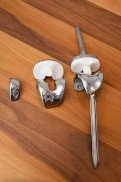 Total Knee Replacement Prosthesis Stockfoto's