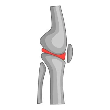 Total knee replacement surgery icon, cartoon style 스톡 일러스트