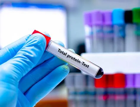 Total protein-Test Stock Photos