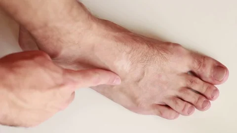 Touching vitiligo blotch on foot Stock Footage 79343663