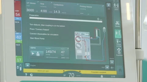 Touchscreen Interface Running on Modern Hemodialysis Unit Close Up Stock Footage 338424635