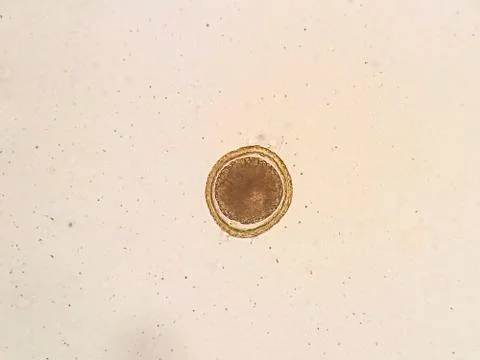 Toxocara cati egg under the microscope Stock Photos