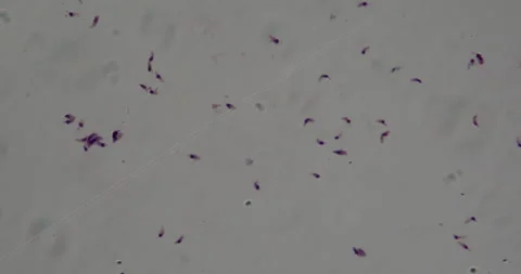 Toxoplasmosis pathogen Stock Footage 144871550