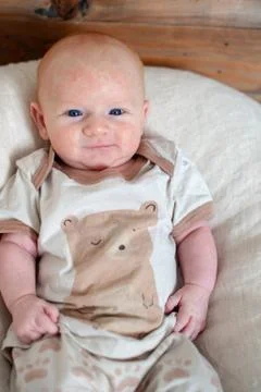 Traces of an allergy on the baby's cheeks Stock Photos