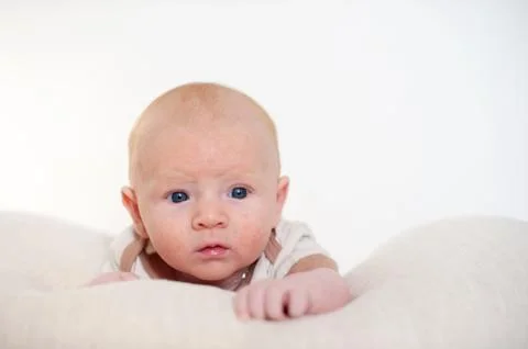 Traces of diathesis Stock Photos