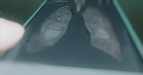 Tracheal anatomy study on anatomy app Stock Footage 313839328