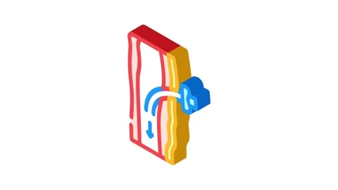 Tracheostomy surgery isometric icon animation Stock Footage 327283075