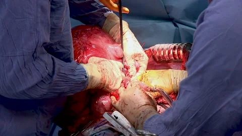 Training of surgeons. A team of surgeons provides training. Close-up Stock Footage 147596328