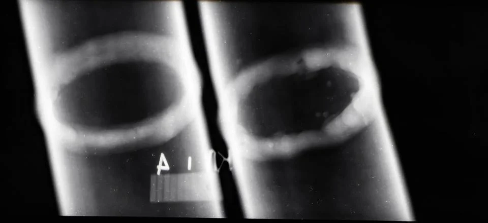 Transcript of x-ray images of welds of pipelines 写真素材