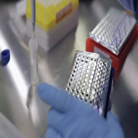 Transferring Solution with an Autoclavable Pipette Stock Footage 69285776