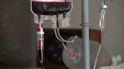 Transfusion system for blood transfusion Stock Footage 67639187