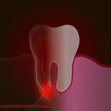 The transition from a real tooth to a point X-ray effect with a point of pain Illustrazione stock