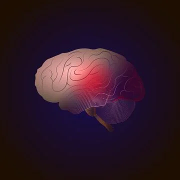 Transition from real to x-ray effect from lines. Brain Diseases with a pain p Stock Illustration