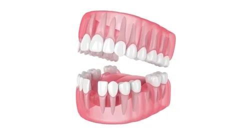 Translucent jaw with missing teeth Stock Footage 137622244