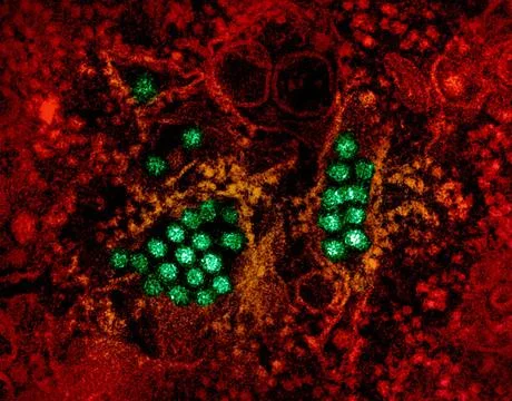  Transmission electron micrograph of dengue virus particles (green). Micro... Stock Photos