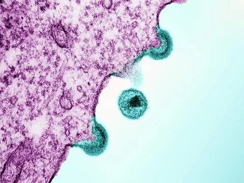  Transmission electron micrograph of HIV-1 virus particles (teal) from inf... Stock Photos