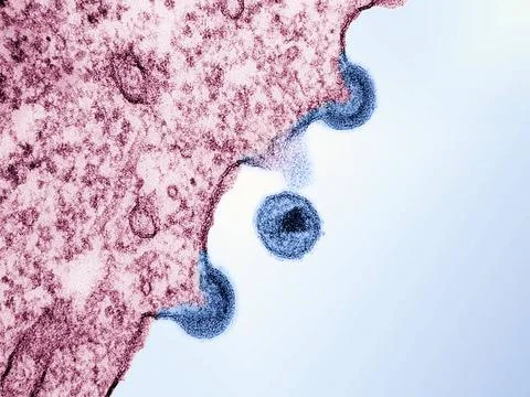  Transmission electron micrograph of HIV-1 virus particles (blue) from inf... Stock Photos