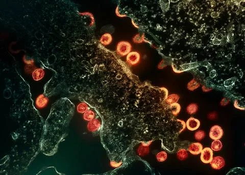  Transmission electron micrograph of HIV-1 virus particles (red/gold) budd... Stock Photos