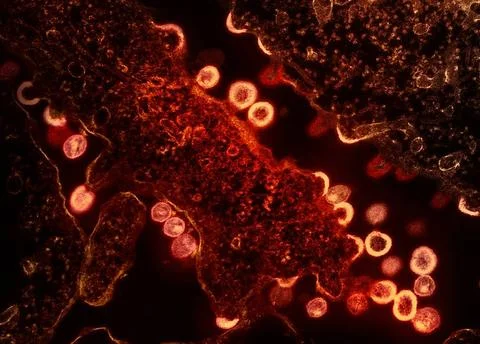  Transmission electron micrograph of HIV-1 virus particles (red/gold) budd... Stock Photos