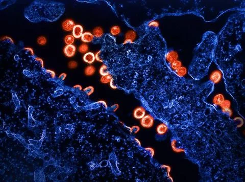  Transmission electron micrograph of HIV-1 virus particles (red) budding a... Stock Photos
