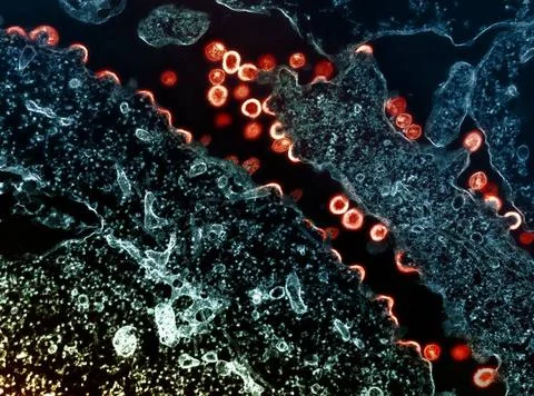  Transmission electron micrograph of HIV-1 virus particles (red/yellow) bu... Stock Photos