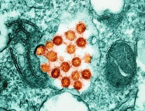  Transmission electron micrograph of SARS-CoV-2 virus particles (colorized... Stock Photos