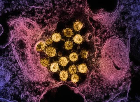  Transmission electron micrograph of SARS-CoV-2 virus particles (colorized... Stock Photos